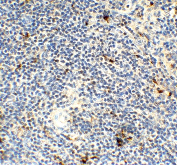 AIMF2 Antibody