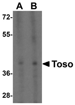 FAIM3 Antibody