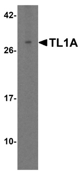 TNFSF15 Antibody