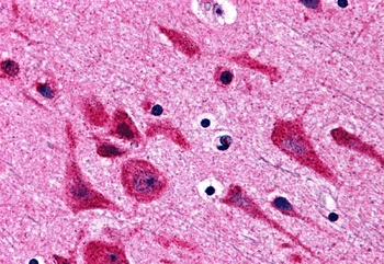 TAB2 Antibody