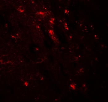 WWC1 Antibody