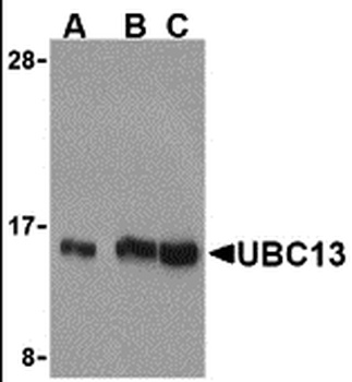 UBE2N Antibody