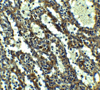 QSOX1 Antibody