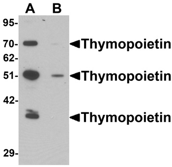 TMPO Antibody