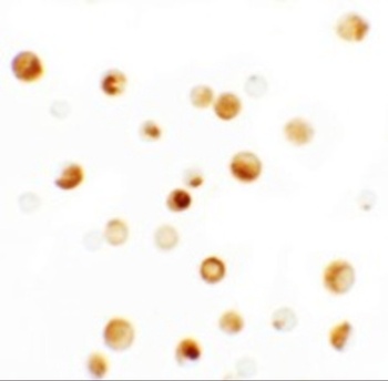 TMPO Antibody