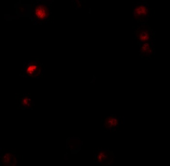 TMPO Antibody