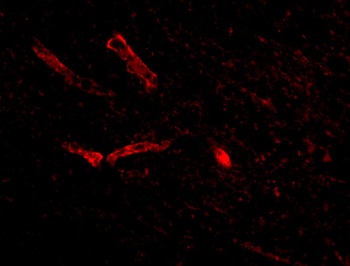 SNPH Antibody