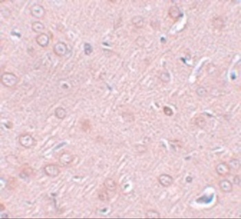 SYNGR2 Antibody