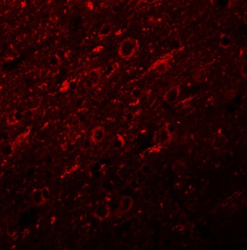 SYNGR2 Antibody