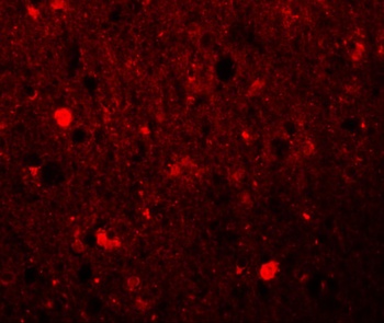 SRPX Antibody