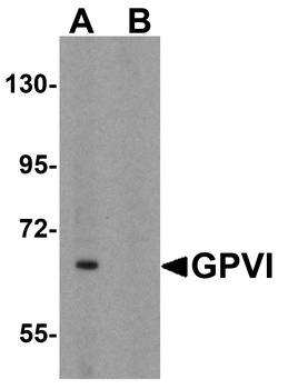 GP6 Antibody