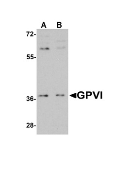 GP6 Antibody