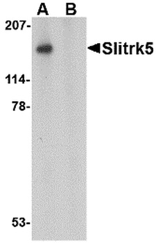 SLITRK5 Antibody
