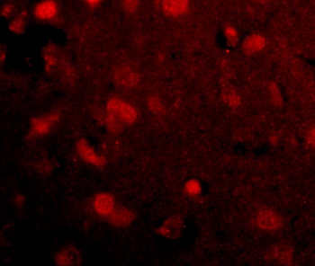 SLITRK4 Antibody