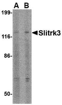 SLITRK3 Antibody