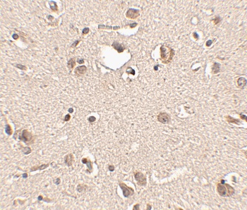 SLITRK3 Antibody