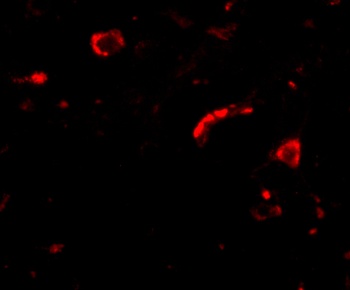 SLITRK3 Antibody