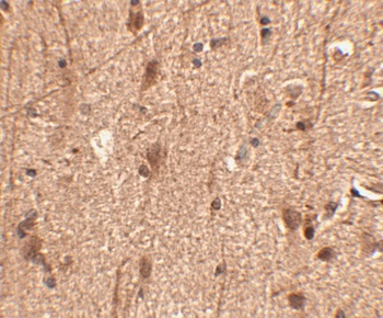 SLITRK3 Antibody