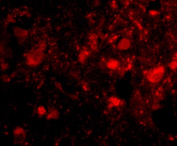 SLITRK3 Antibody