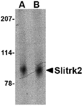 SLITRK2 Antibody