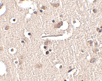 SLITRK2 Antibody