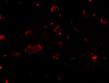 SLITRK2 Antibody