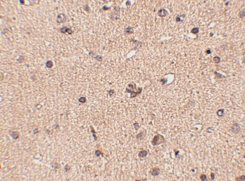 SLITRK2 Antibody