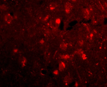 SLITRK2 Antibody
