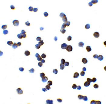 SLCO1B1 Antibody