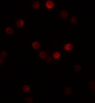 GEMIN2 Antibody