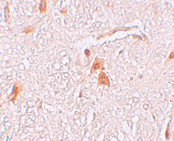 SHISA9 Antibody