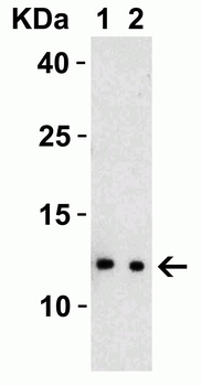 SARS-CoV-2 (COVID-19) NSP8 Antibody