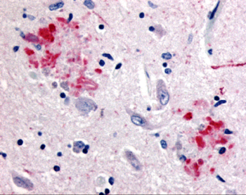 APP Antibody