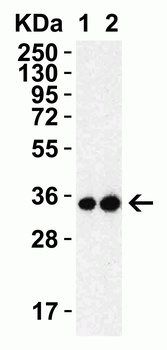 SARS-CoV-2 (COVID-19) 3CL-PRO (NSP5) Antibody