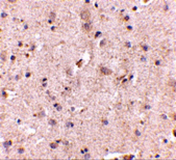 DLGAP2 Antibody