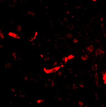 DLGAP2 Antibody