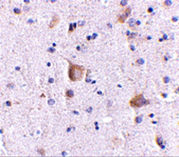 RIMS2 Antibody