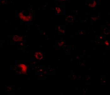 RIMS2 Antibody