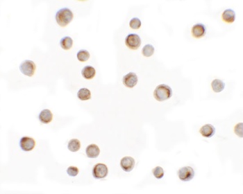 RILP Antibody