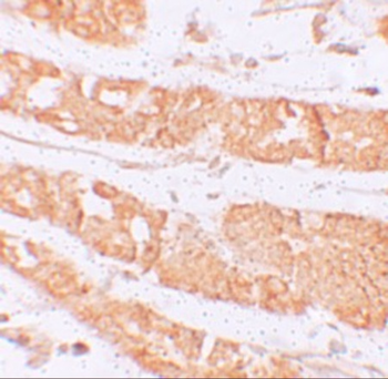 HMMR Antibody