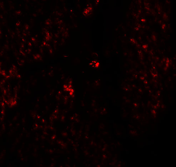 HMMR Antibody