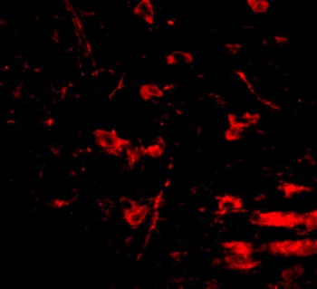 Rcan2 Antibody