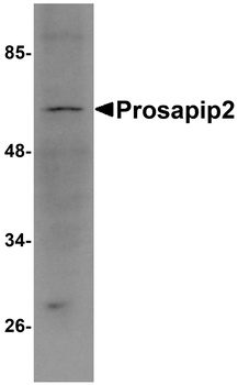 TBKBP1 Antibody