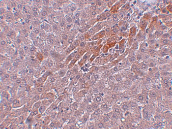 TBKBP1 Antibody