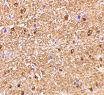 RTN4 Antibody