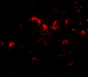NIPSNAP3B Antibody