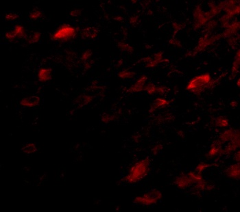 NIPSNAP3A Antibody