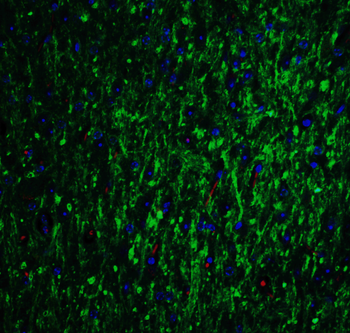 GLS2 Antibody