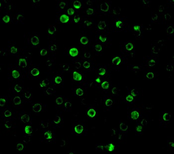 IL-22 Receptor Antibody