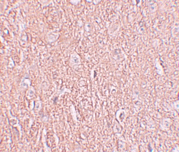 LRRTM2 Antibody